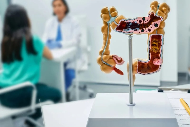 Tanger accueille des chirurgiens proctologues | Exprès TV