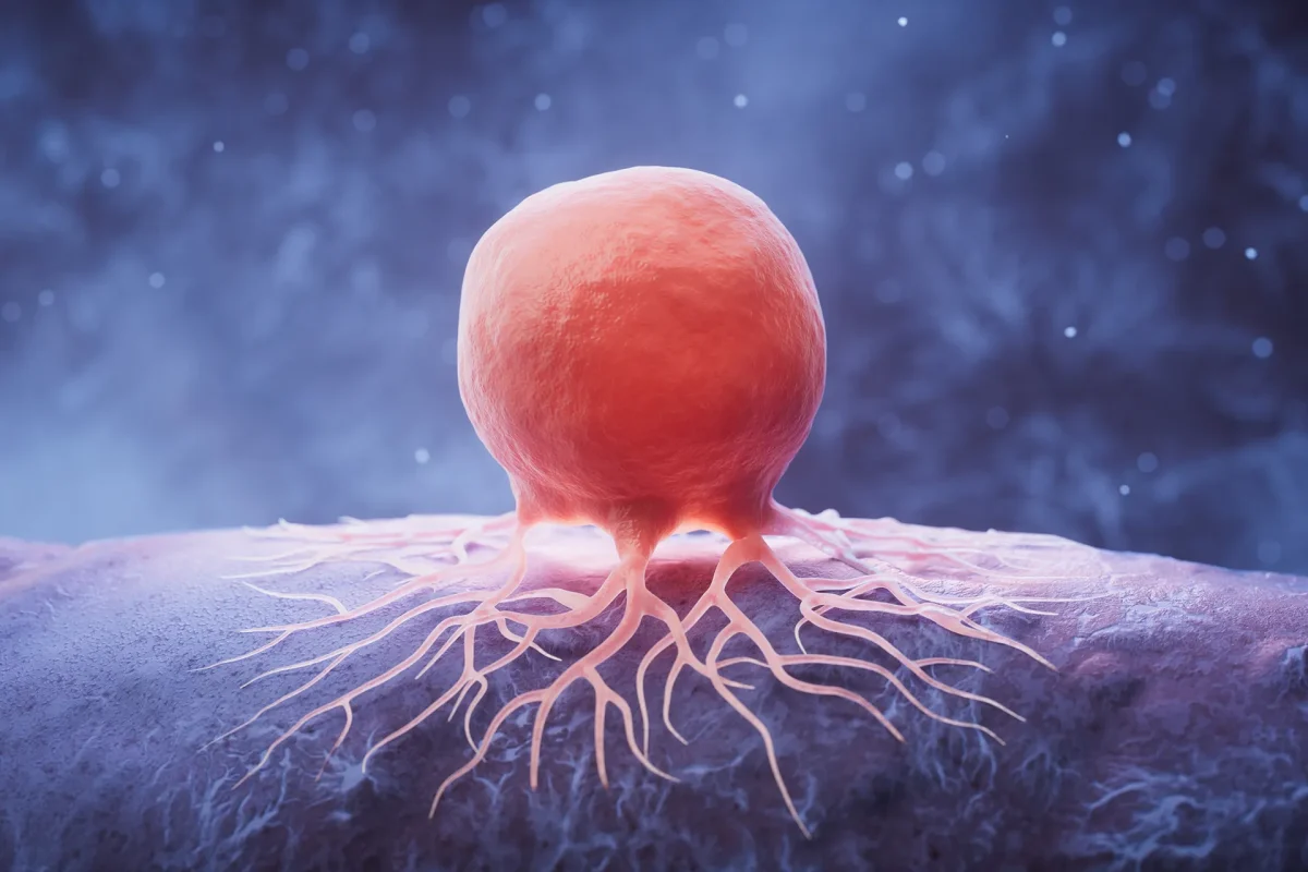 Innovation scientifique permettant aux médecins de suivre le cancer sans substances radioactives